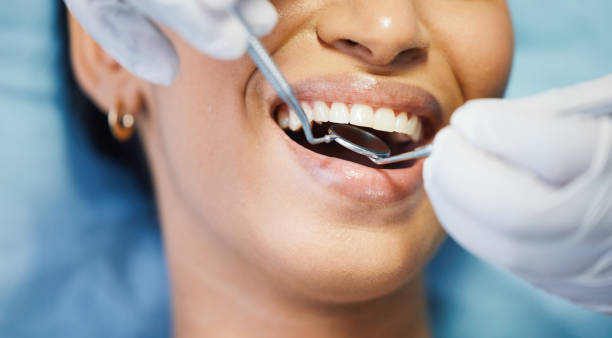 Best Emergency Treatment for Dental Infections or Abscesses in Bernie, MO