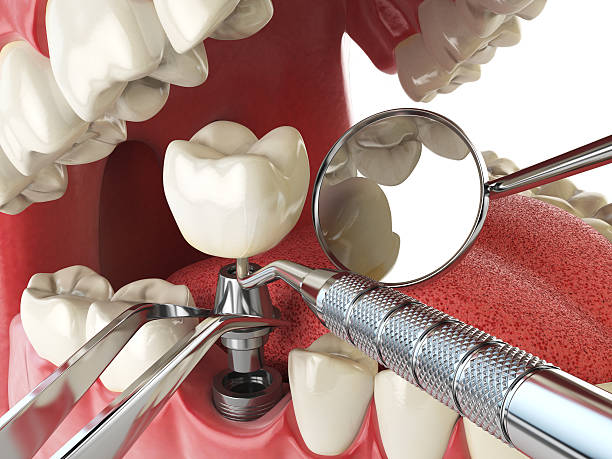 Best Weekend Emergency Dentist in Bernie, MO